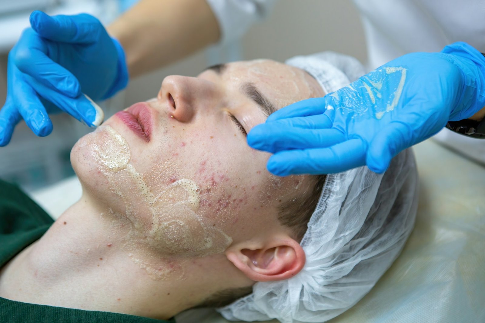 A young Caucasian teenage boy has a cosmetologist cleaning his face. A dermatologist treats acne on