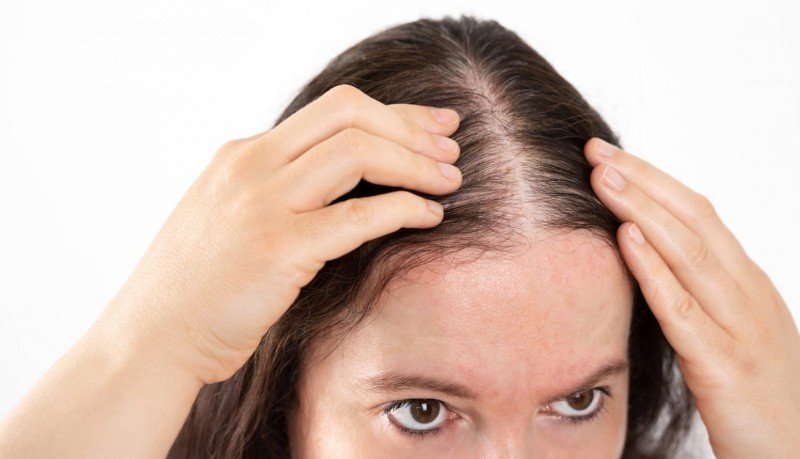 Best Tips To Prevent Hair Fall In Women