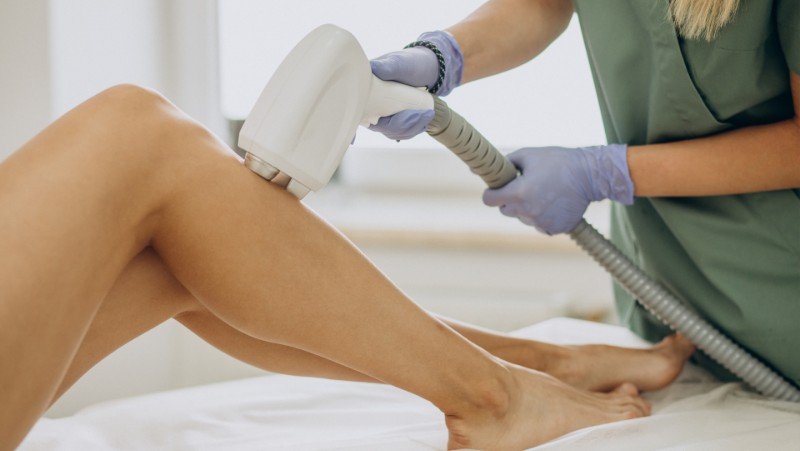 Laser Hair Removal Cost Bangalore