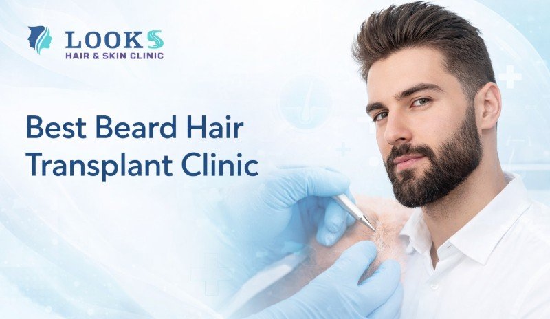 Beard Hair Transplant Clinic in Bangalore